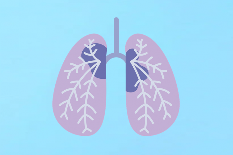 肺がん検診イメージ